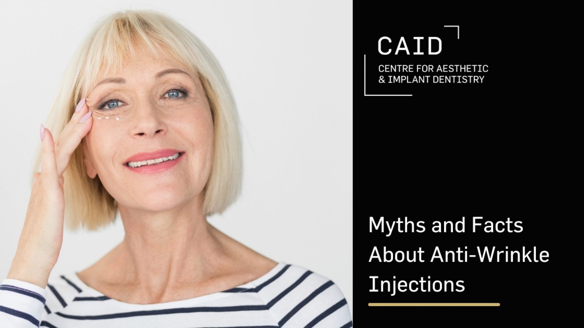 Myths and Facts about Anti Wrinkle Injections