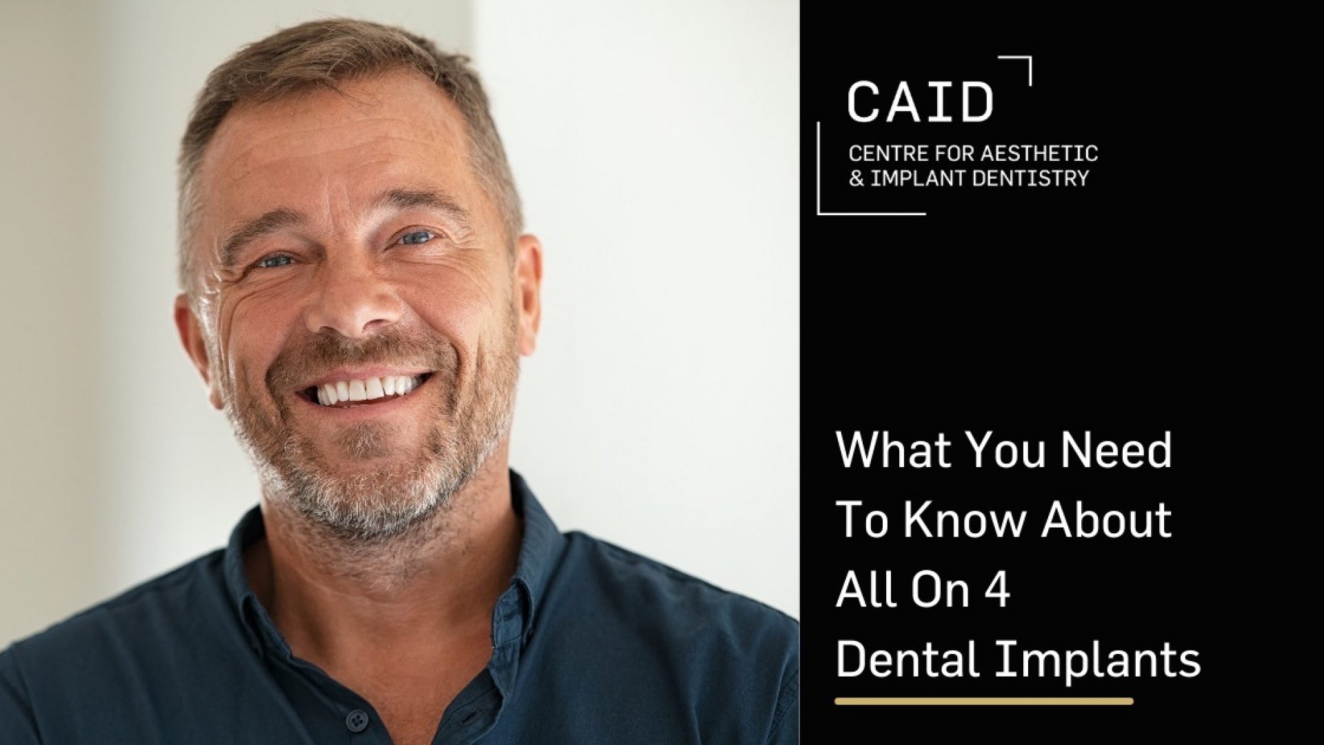 What You Need to Know about All On 4 Dental Implants
